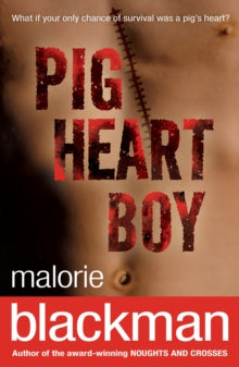 Pig-Heart Boy by Malorie Blackman (Author)
